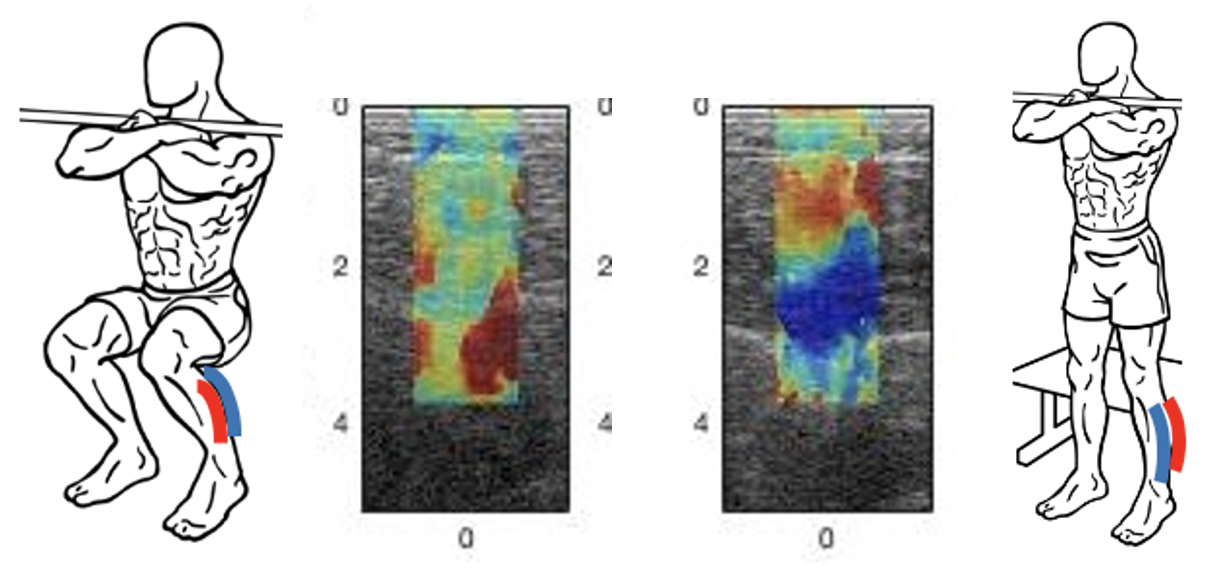 Sound speed maps showing dynamics of muscle activation